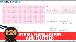 Rate and Rhythm  Atrial Fibrillation and Atrial Flutter [upl. by Lyndel]