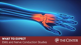 What to Expect During Nerve Conduction Studies and EMG Tests [upl. by Eifos]