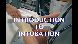 Awake intubation [upl. by Accisej]