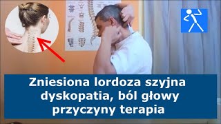 Spłycona zniesiona lordoza szyjna  Przepuklina szyjna  Dyskopatia  Objawy ćwiczenia 🇵🇱 🇪🇺 [upl. by Mariandi119]