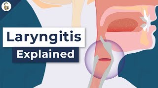 Why Do You Lose Your Voice  Laryngitis Explained [upl. by Leena]