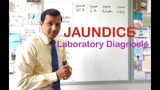 Jaundice  Laboratory Diagnosis [upl. by Restivo]