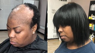 Custom Made Bob Wig  Shaved Clients Head Psoriasis amp Mild Alopecia Tutorial [upl. by Sanson]