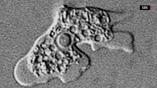 How dangerous are brain eating amoeba [upl. by Akaya]