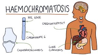 Understanding Haemochromatosis [upl. by Rosaline215]