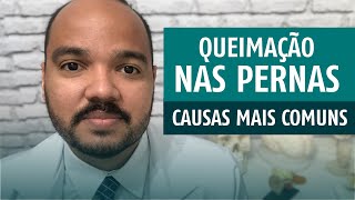 QUEIMAÇÃO NA PERNA Causas mais comuns [upl. by Arraeit]