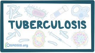 NEURORADIOLOGY CNS Infections  I  DEEPAK PATKAR  Tuberculomas vs Cysticercosis [upl. by Narual]