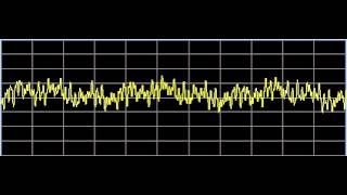 Inflammation  Rife Frequencies [upl. by Anemij]