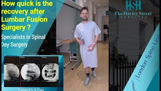 How quick is the recovery after Lumbar Fusion Surgery [upl. by Annelise70]