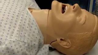 Failed extubation in the ICU from AOD [upl. by Yeliac]