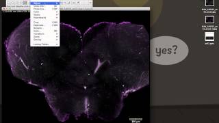 Calculate Area in ImageJ [upl. by Eelydnarb375]