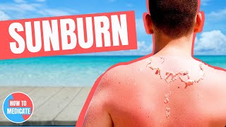 How to treat a Sunburn  Doctor Explains [upl. by Emmet]