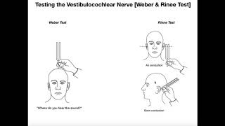 Interpreting the WeberRinne Tests EXPLAINED [upl. by Marja571]