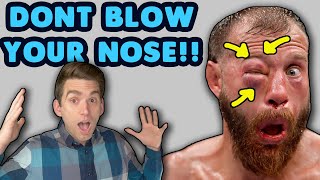 Doctor REACTS to Donald Cerrone EYE SWOLLEN After He Blows Nose at UFC 238 [upl. by Marlene]