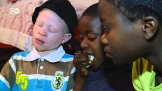 Kenya  Albinos Face Deadly Superstition  Global 3000 [upl. by Lizned]