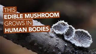 This Edible Mushroom Grows In Human Bodies [upl. by Cocke570]