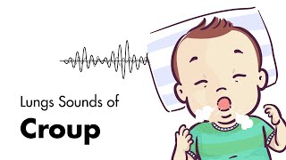 Sounds of Croup Laryngotracheitis  Lung Sounds  MEDZCOOL [upl. by Kial]