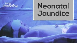 Neonatal Jaundice  Causes Symptoms and Treatment [upl. by Alleris458]