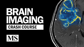 fMRI Analysis Part 1  Preprocessing [upl. by Tibbitts371]