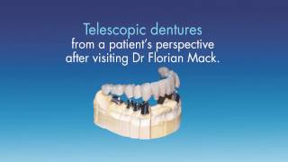 Telescopic Dentures by Dr Florian Mack [upl. by Nyroc]