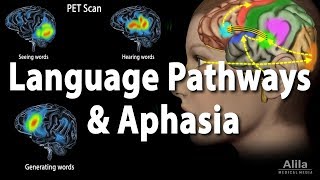 Language Pathways and Aphasia Animation [upl. by Hedva]