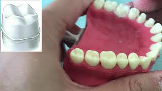 CROWN PREPARATION TUTORIAL MAXILLARY MOLAR [upl. by Tiffanie239]