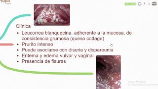 Candidiasis Vaginal Signos y síntomas  Diagnóstico  Tratamiento [upl. by Nylecsoj66]