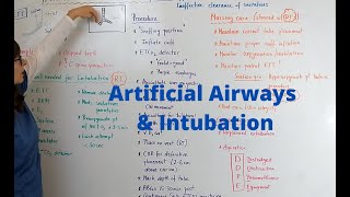 Intubation Tips and Tricks [upl. by Nerradal]