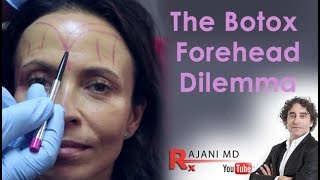 Botox Forehead Dilemma Explained Dr Rajani [upl. by Paulo]