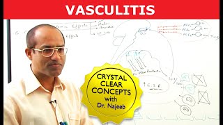 Vasculitis  Causes Symptoms amp Treatment [upl. by Estus]