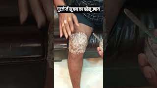 4 घंटे में घुटने का सूजन दर्द गायब 3 में से कोई 1 घरेलू उपाय कर लें  knee pain treatment knee pain [upl. by Broeker]