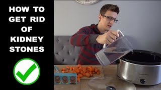 How to Get Rid of Kidney Stones [upl. by Arac56]