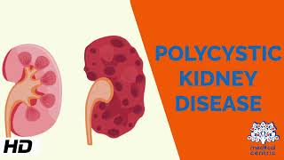 Polycystic Kidney Disease  Internal medicine by Dr Rajesh Gubba [upl. by Damalas]