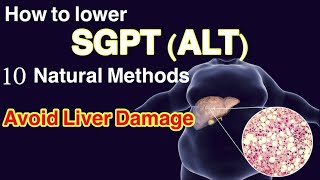 How to lower SGPT ALT levels 10 natural methods  How to Lower Alt Level How to Avoid Liver Damage [upl. by Patti]