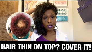 Natural Hairstyles for THINNING Crown [upl. by Acinnej]