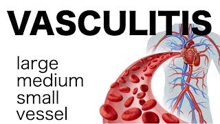 Vasculitis [upl. by Accalia124]