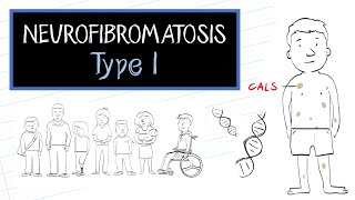 What is Neurofibromatosis Type 1 NF1 [upl. by Ettenrahs176]