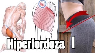 Pogłębiona lordoza lędźwiowa ból pleców  JAK SKORYGOWAĆ cz1 Anatomia [upl. by Salta965]