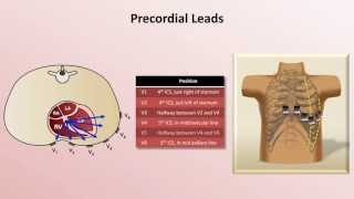 Intro to EKG Interpretation  EKG Leads [upl. by Colby]