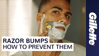 Want to Prevent Razor Bumps Learn How to Minimize Ingrown Hairs  Gillette [upl. by Nilam]