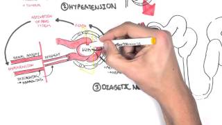 Chronic Kidney Disease CKD Pathophysiology [upl. by Jankell]