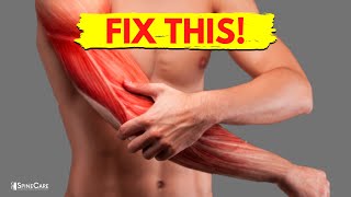 How to Fix Arm Muscle Pain in 30 SECONDS [upl. by Beard]