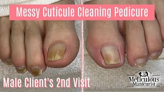 DIY Pedicure at Home for Men with Messy Cleaning  2nd Visit [upl. by Kcirdnek254]