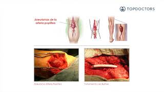 Anatomy  Abdominal Aorta Branches [upl. by Ahsael705]