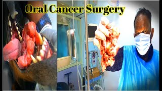 Oral cancer Surgery in Doberman  Tumor Surgery in Dog [upl. by Nivlad33]