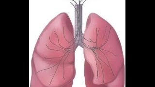 BREATH SOUNDS Stages of Fluid Overload Pneumonia [upl. by Anson966]