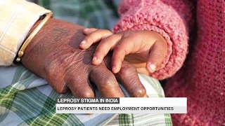 The stigma of leprosy in India [upl. by Lody]