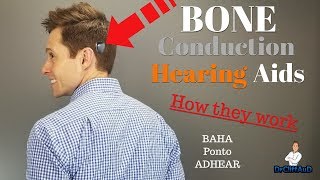 How Bone Conduction Hearing Aids Work  Cochlear BAHA Oticon Medical Ponto Medel ADHEAR [upl. by Lladnik134]