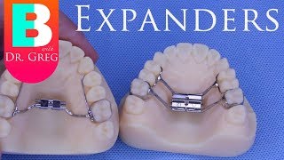 BRACES EXPLAINED Palatal Expanders [upl. by Phalan]