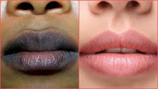 COMO ACLARAR LOS LABIOS OSCUROS REMEDIO CASERO MUY EFECTIVO [upl. by Shannah]